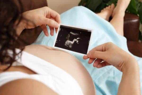 Siêu âm tầm soát dị tật thai 18 tuần đến 22 tuần – Siêu âm hình thái thai